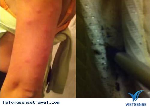 Rận Khổng Lồ Tấn Công khách thăm quan Tại Thành Phố New York - Ảnh 1